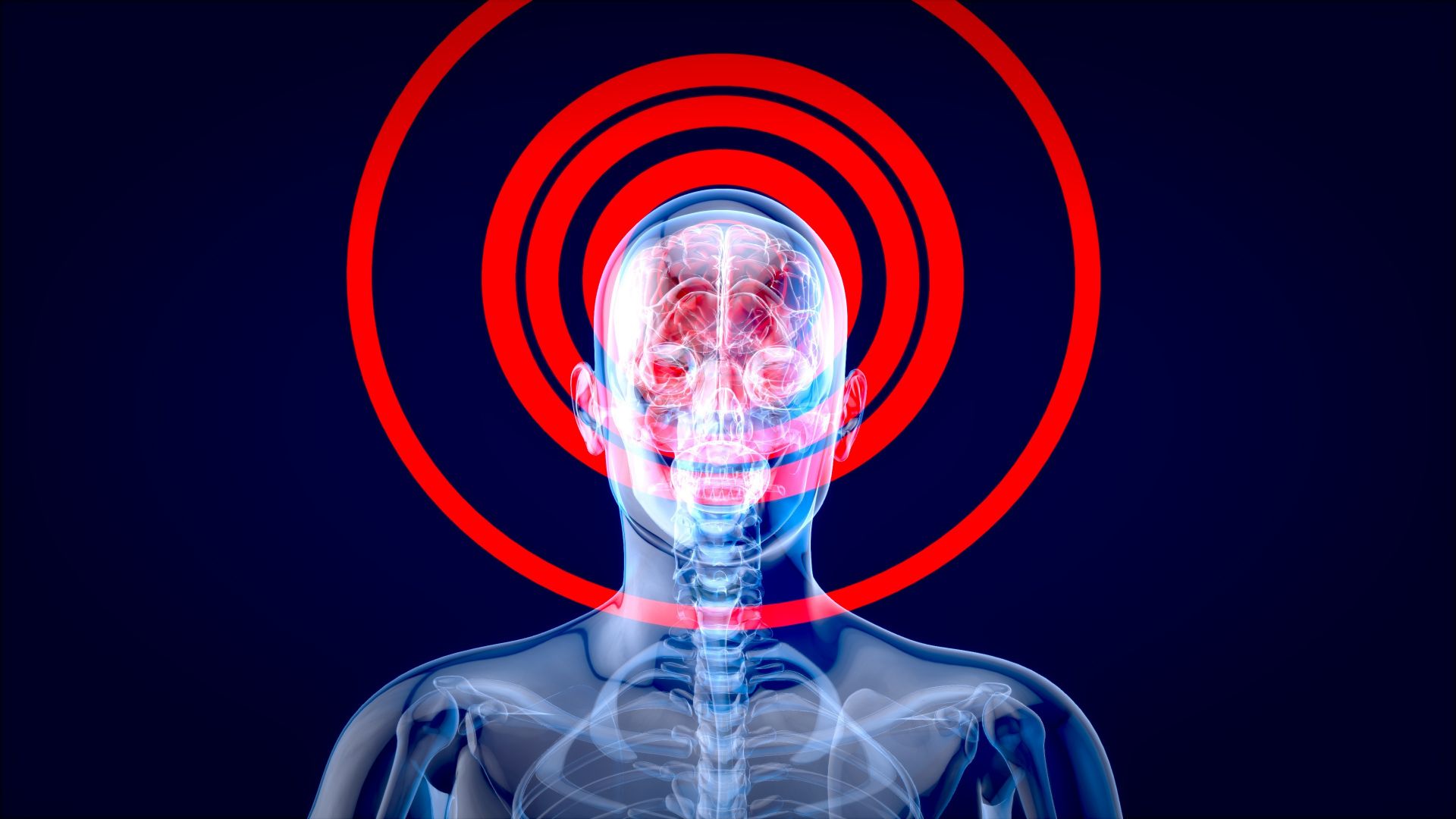 Widoczny na zdjęciu mózg nieustannie reaguje na bodźce. A jaka jest reakcja mózgu na ból?